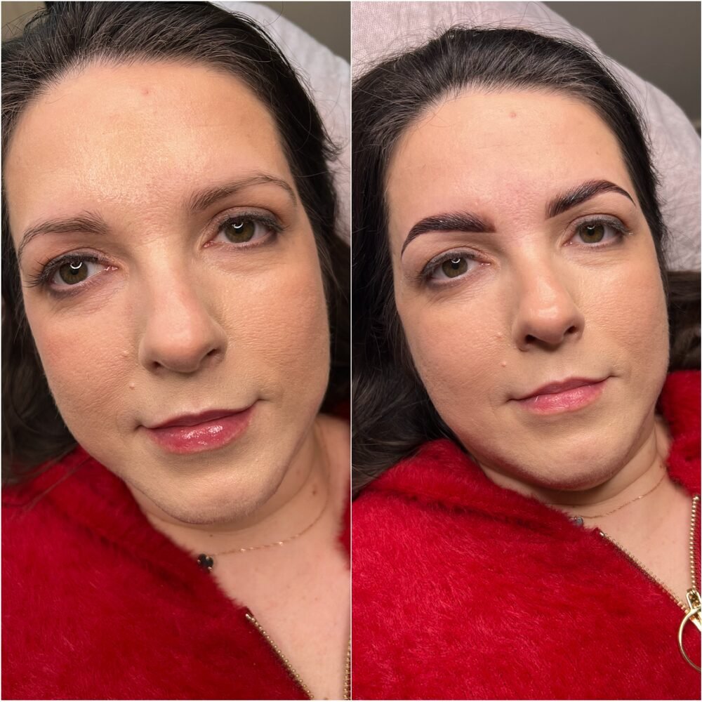 Eyebrow treatment before and after, showing fuller shaped brows
